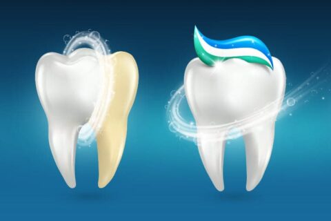 7 Gründe für eine professionelle Zahnreinigung. Illustration mit zwei Zähnen